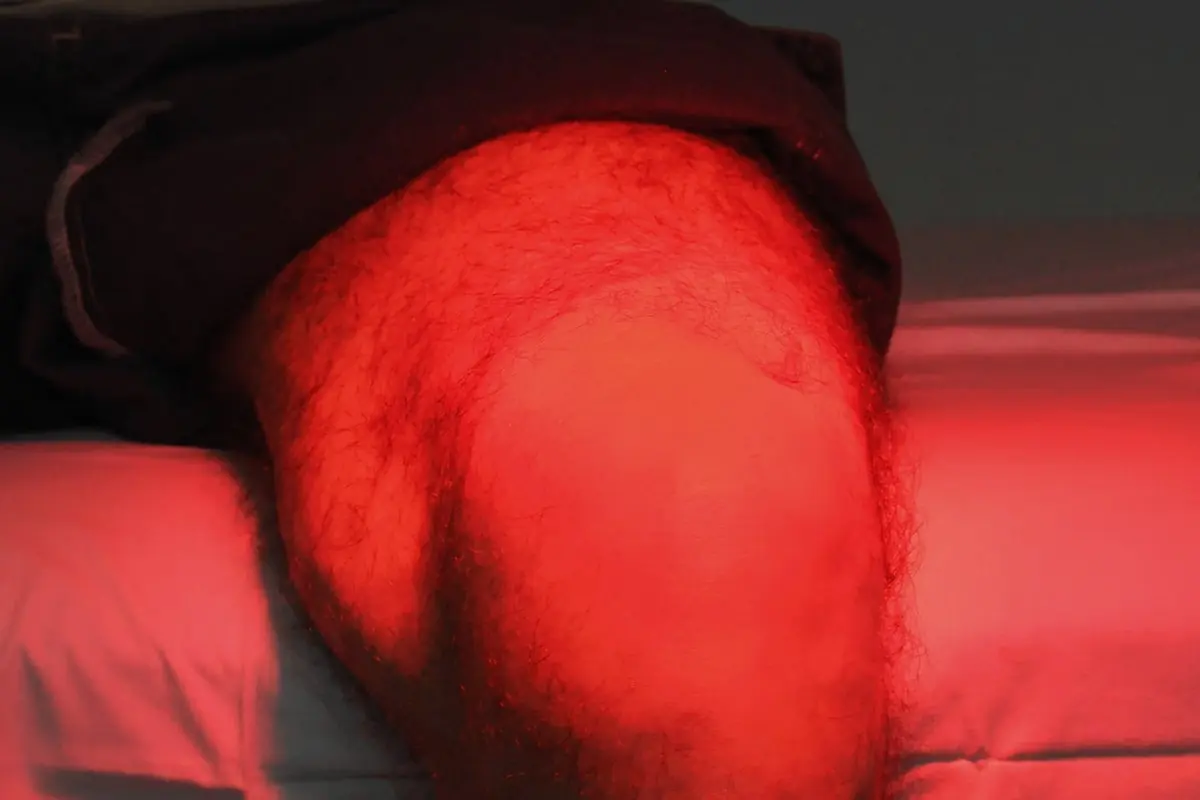 Aplicação de luz infravermelha durante sessão de fisioterapia