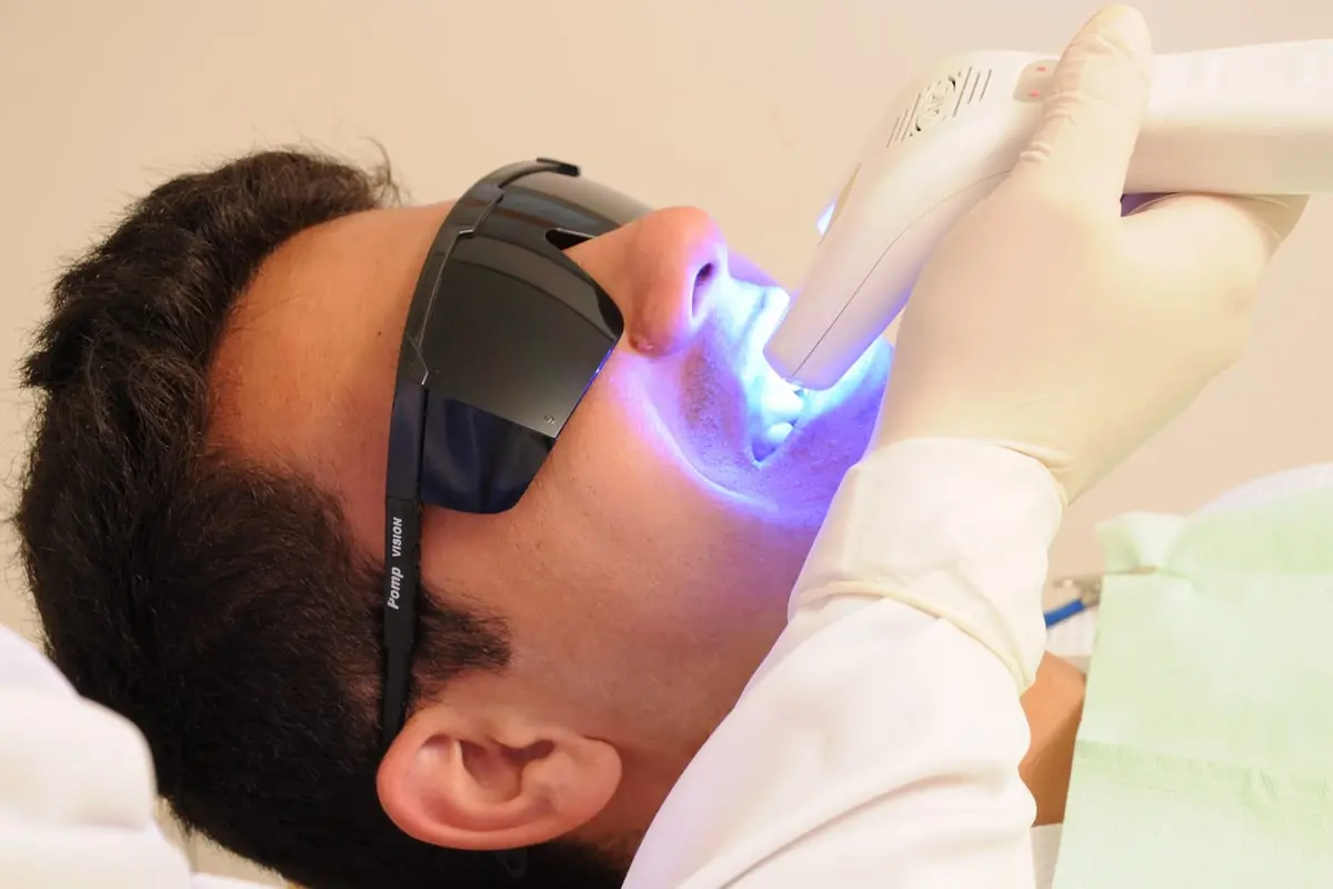Aplicação de laser odontológico, com o paciente de óculos de proteção